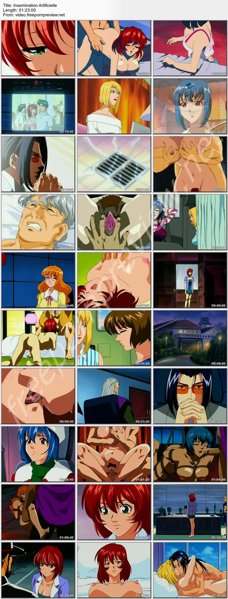 Insemination Artificielle