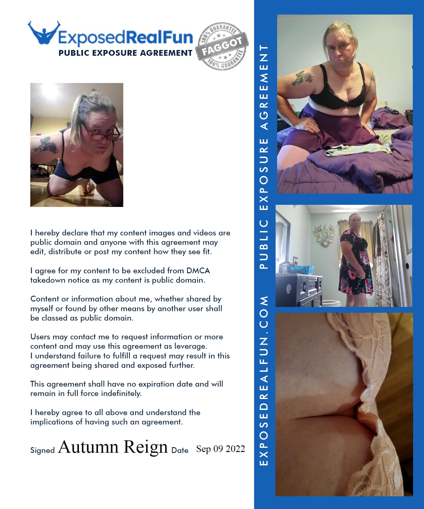 Public Exposure Agreement