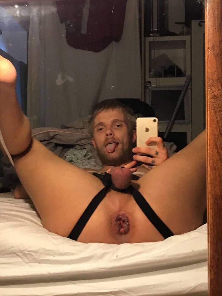 DANISH PROLAPSE