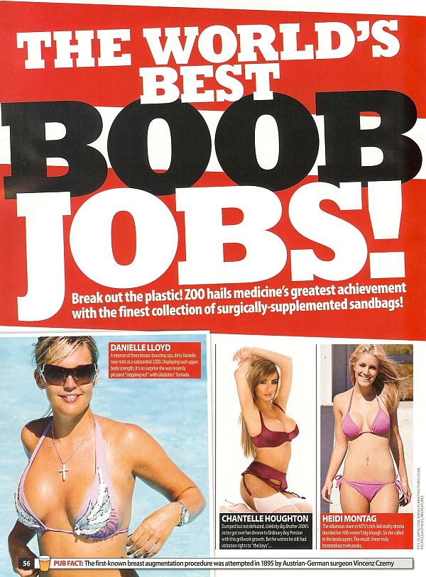 ZOOs Worlds Best Boob Jobs. Click Pic For Gallery.