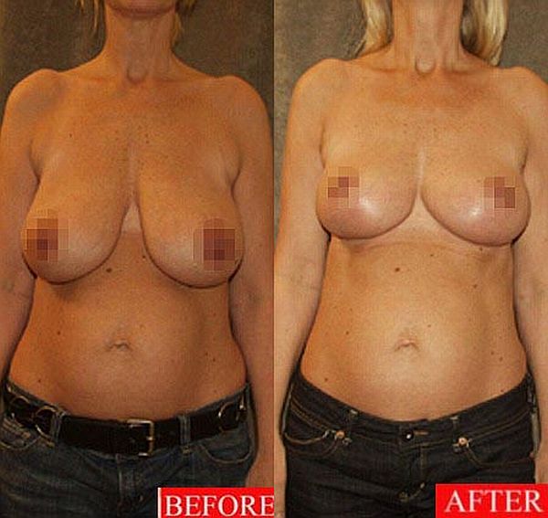 Britain Has Talent: Ulrika Jonsson Tit Job And Susan Boyle Hard Nipples