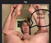 Exposed exposure lol