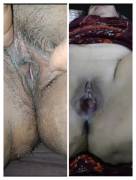 Beautiful women big pussy