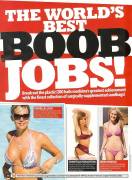 ZOOs Worlds Best Boob Jobs. Click Pic For Gallery.