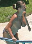 Kerry Katona Topless At 36DD